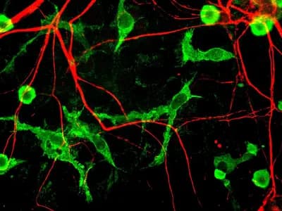 Microglia, stained green, among neurons stained red in a mixed rat brain cell culture